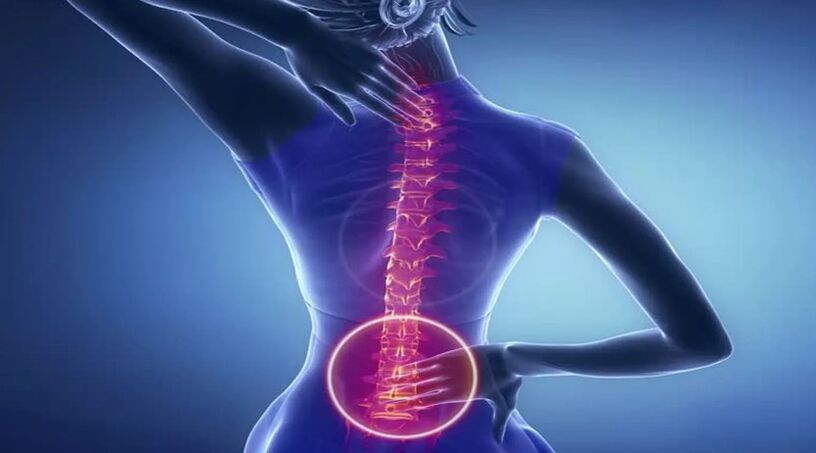 Osteochondrosis of spine
