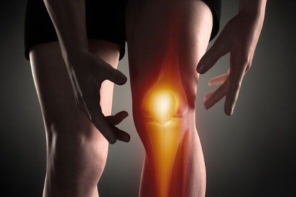 Knee wrist arthrosis