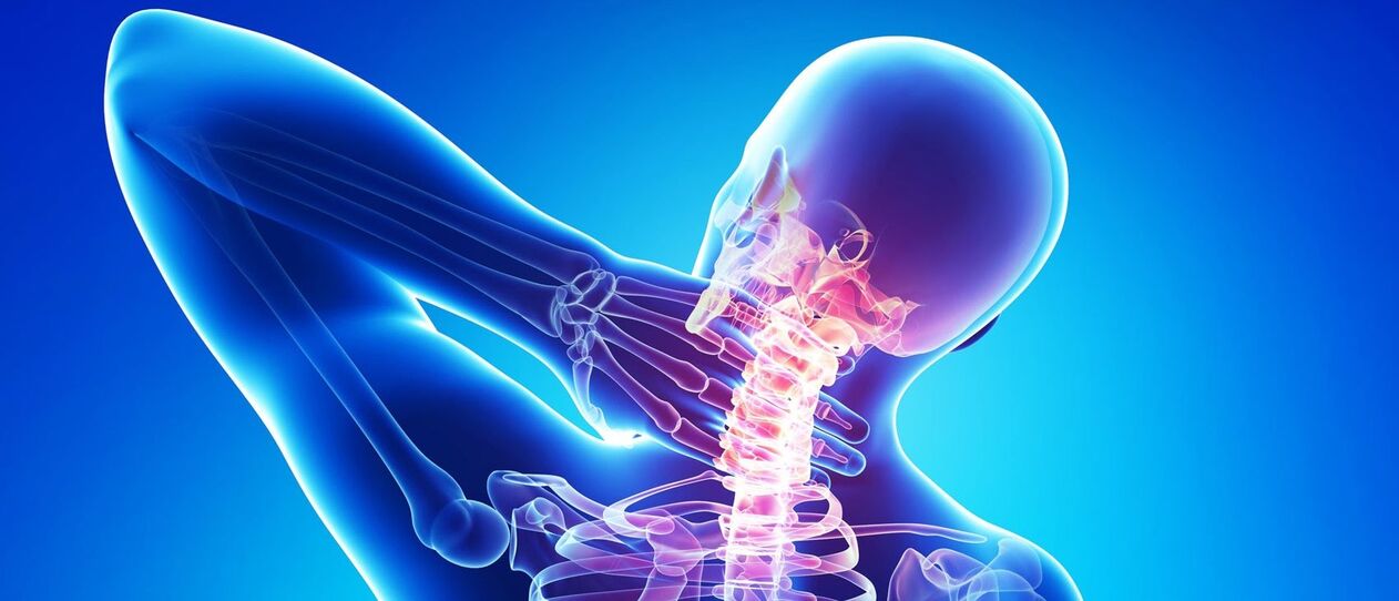 Cervical osteochondrose is a pathological process in the area of ​​spine